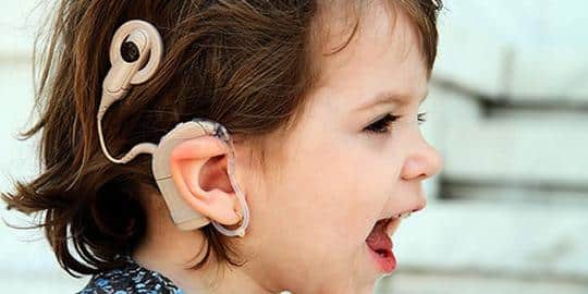 Implante Coclear para perda auditiva em crianças