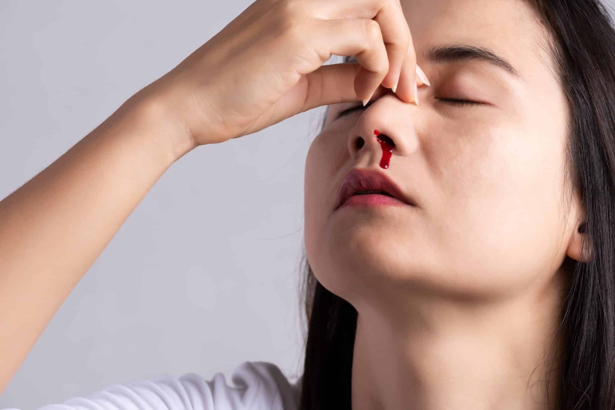 Sangramento nasal (ou epistaxe): Causas e Tratamento – Dra. Simone ...